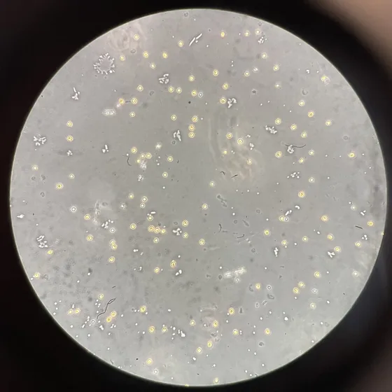 Phase contrast microscopy of Chlorella vulgaris at 400×