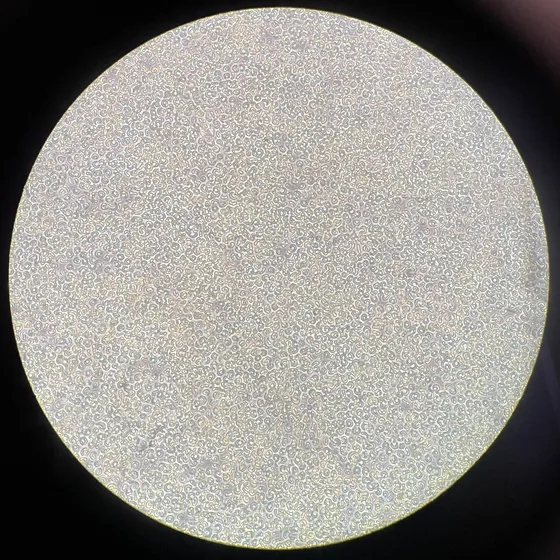 Dense phase contrast microscopy of Raphidocelis subcapitata at 400×